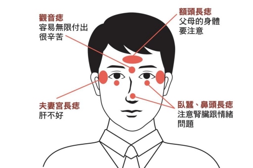 面部哪些痣必须点掉