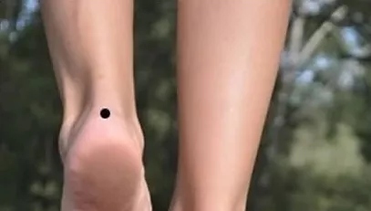 左脚脚后跟有痣的女人代表什么