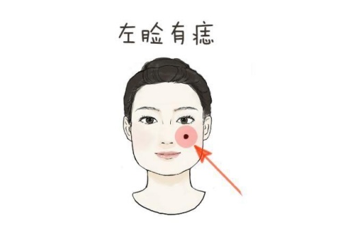 左脸有痣的女人代表什么