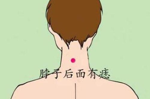 后脖上有痣的女人婚姻好吗